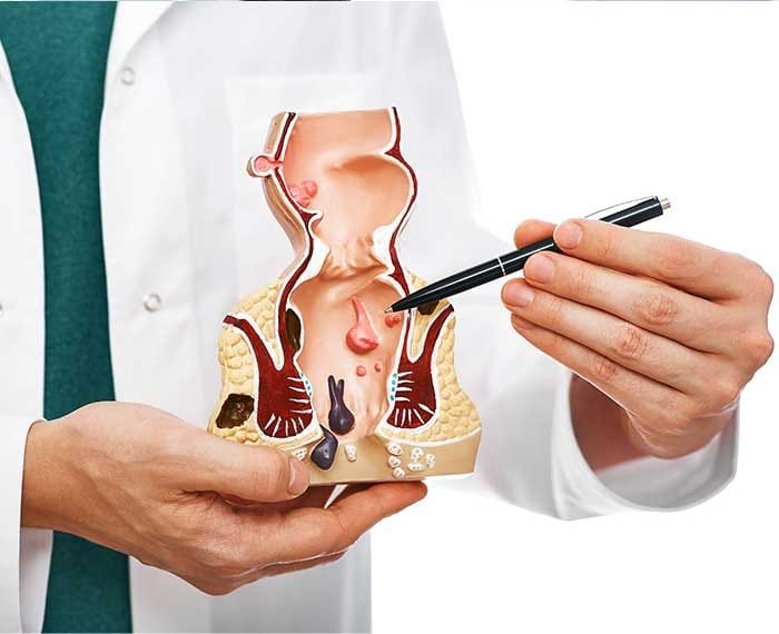 Proctology in Ayurveda